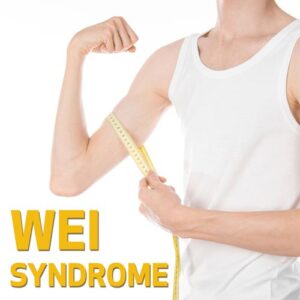 Síndrome Wei